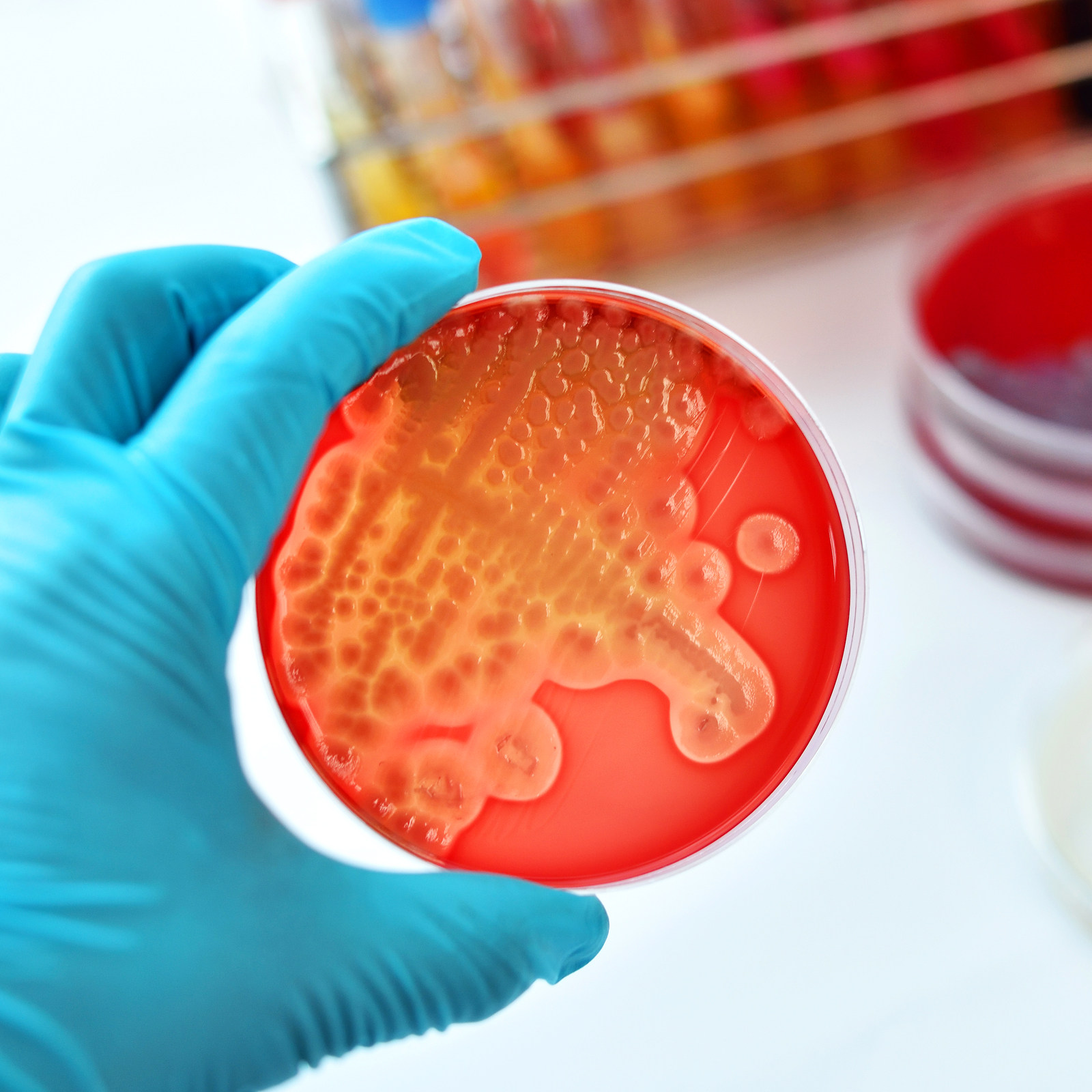 20Pcs Pre-Poured Nutrient Agar – Agar Tissue Culture recenzja i cena